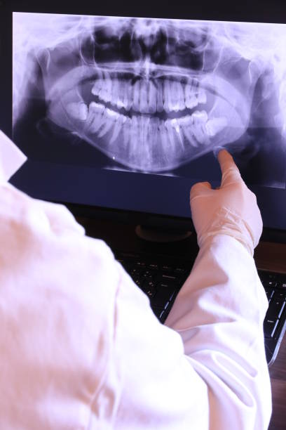 Best Emergency Tooth Extraction in Wimberley, TX