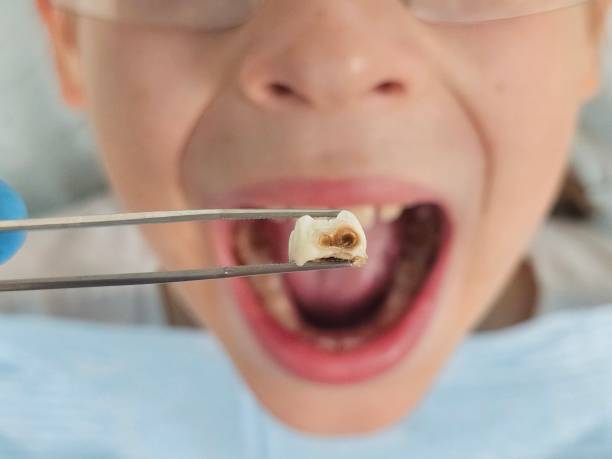 Best Emergency Treatment for Toothache in Wimberley, TX